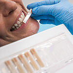 COI Clinica Dental Granollers - Estetica Dental - Reconstrucción con composite