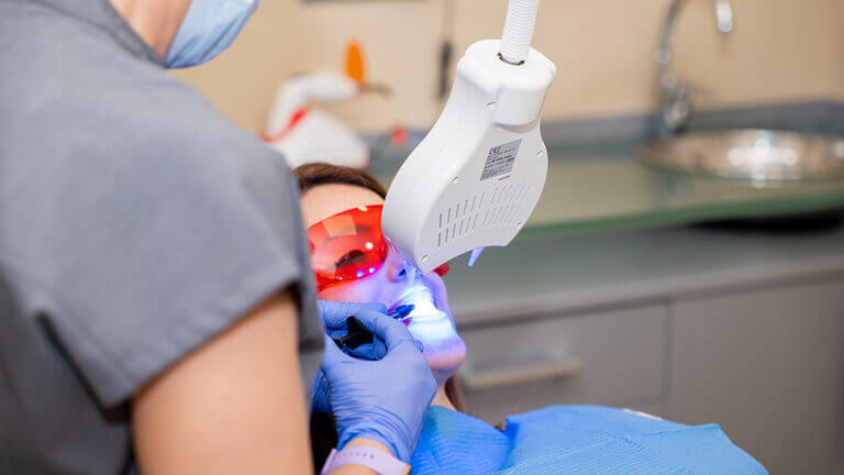 Blanqueamiento dental ¿qué es, qué tipos hay y cuánto dura?