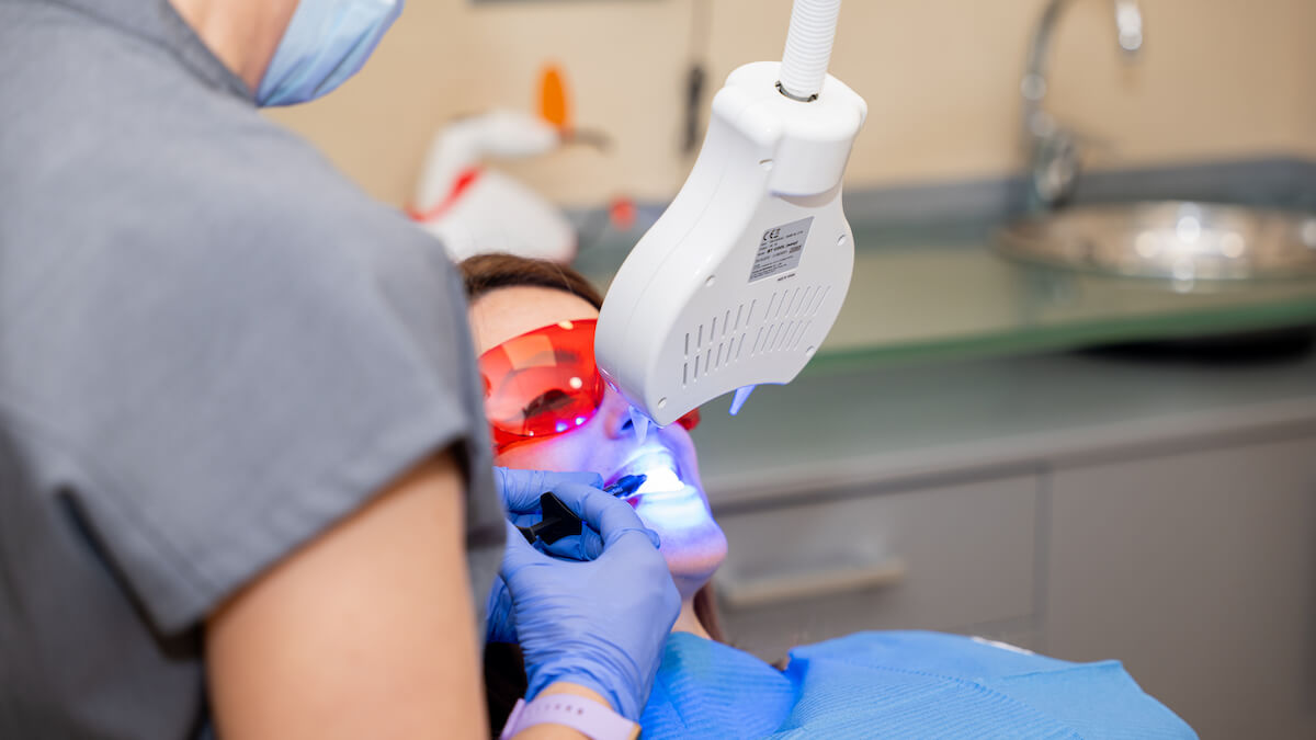Blanqueamiento dental ¿qué es, qué tipos hay y cuánto dura?