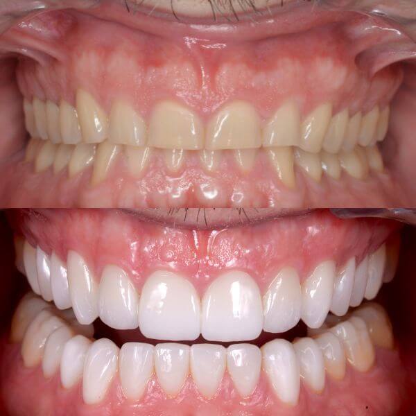 Rehabilitación oral