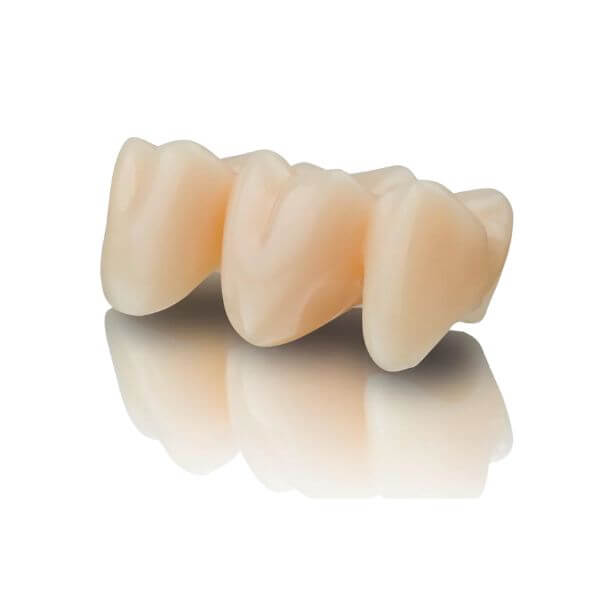 Puentes dentales Granollers