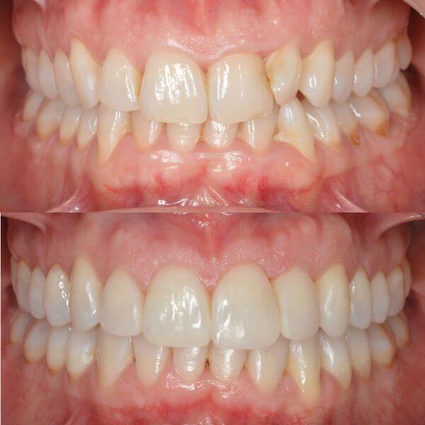 Ortodoncia y periodoncia en Granollers