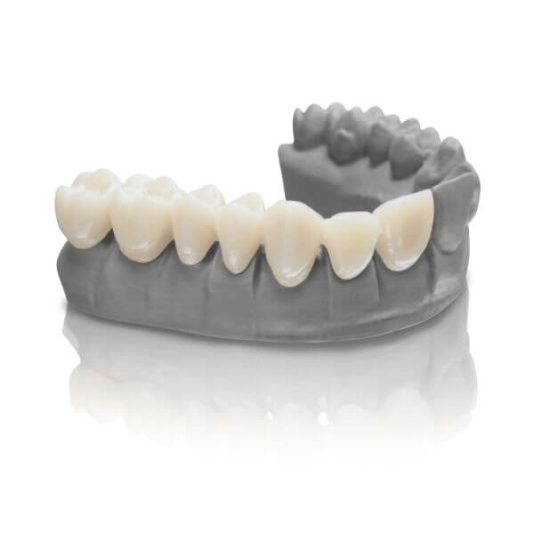 Puentes dentales Granollers