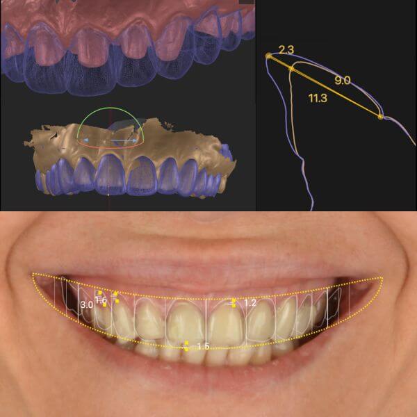 Tecnología digital para rehabilitación oral en Granollers