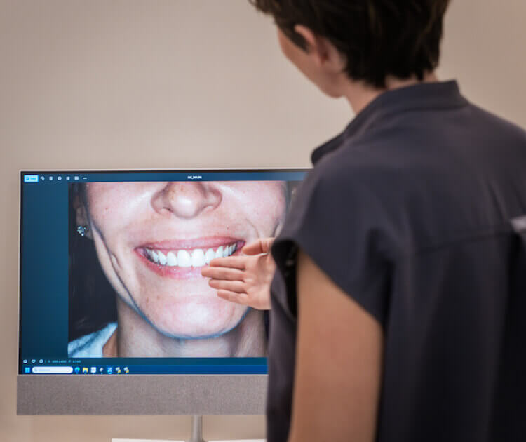 Rehabilitación oral en Granollers