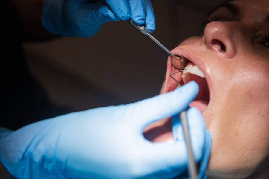 Sensibilidad dental - tratamientos