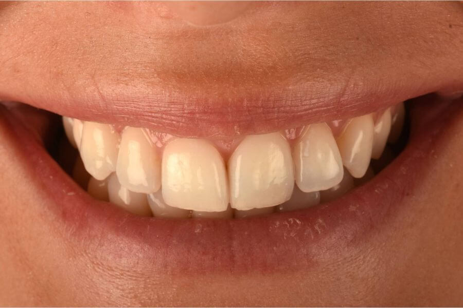 After image