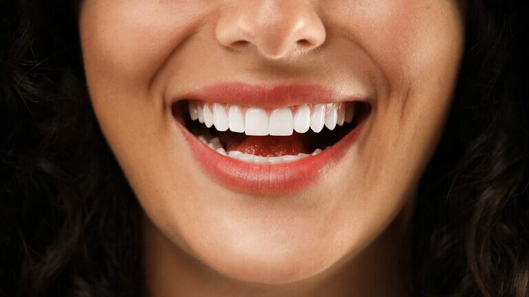 Tipos de carillas dentales
