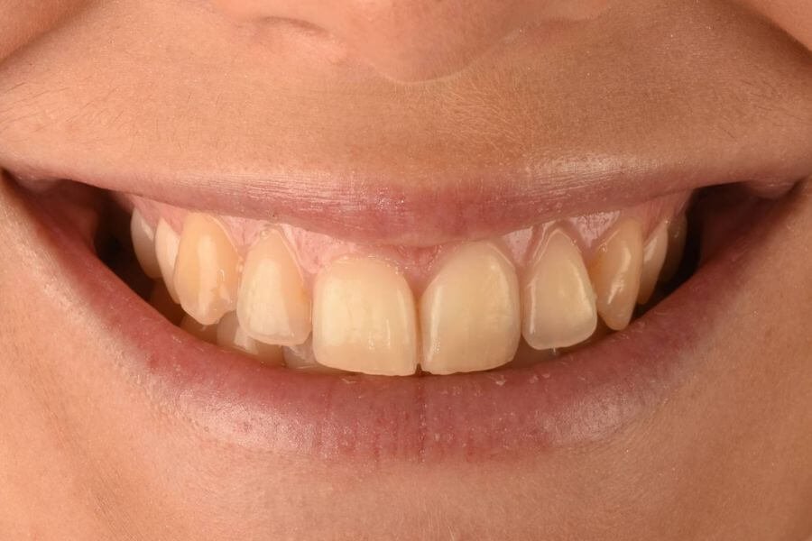 Before image