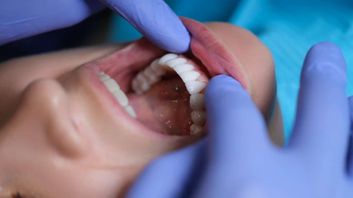 Qué es una reconstrucción dental