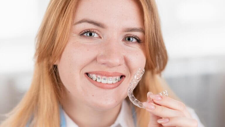 Ortodoncia invisible o brackets