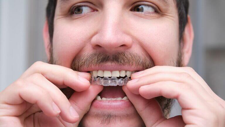 Vale pena la ortodoncia en adultos