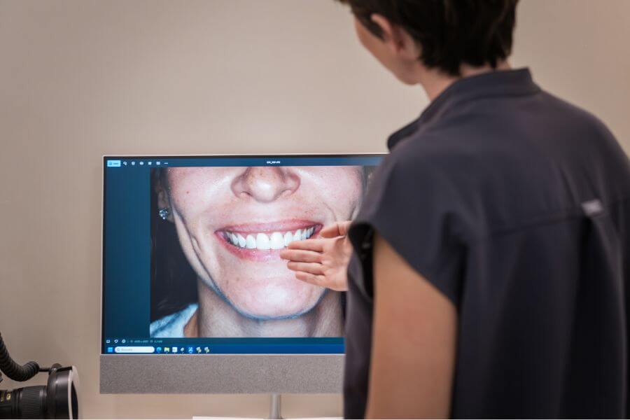 blanqueamiento dental combinado