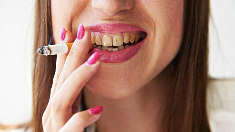 Manchas de tabaco en lso dientes