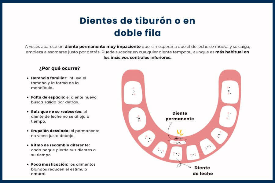 Causas de los dientes de tiburón en niños