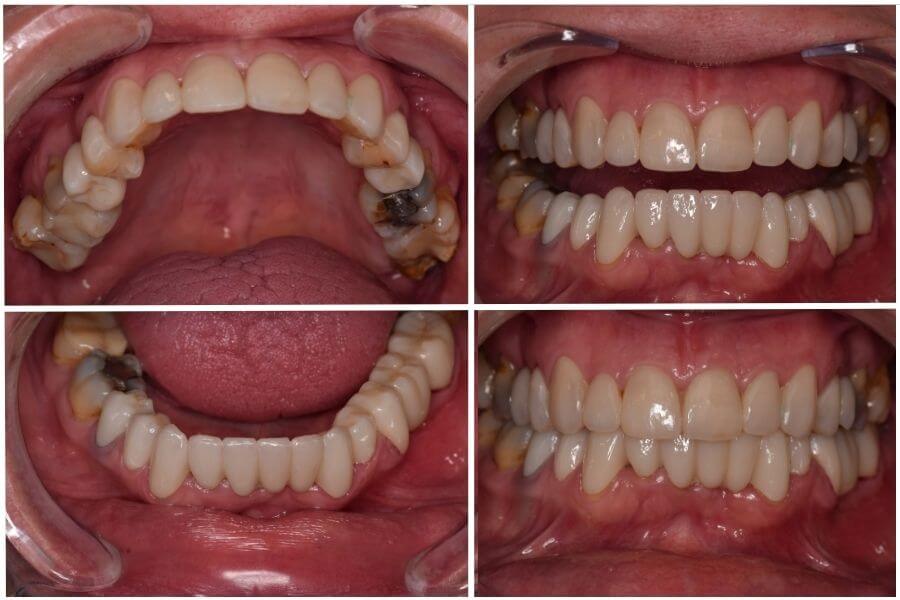 rehabilitación oral integral