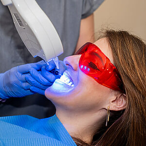COI Clinica Dental Granollers - Blanqueamiento Dental - Blanqueamiento LED en Clinica