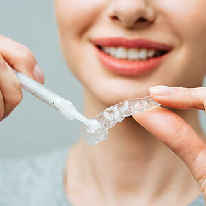COI Clinica Dental Granollers - Blanqueamiento Dental - Blanqueamiento en Casa