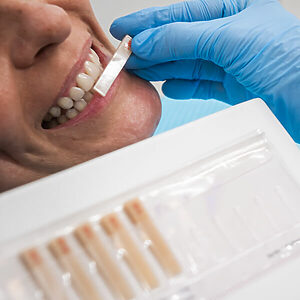 COI Clinica Dental Granollers - Estetica Dental - Reconstrucción con composite