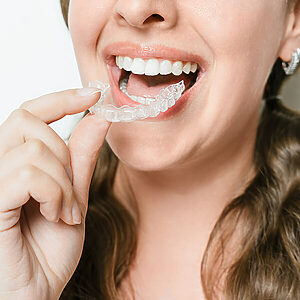 COI Clinica Dental Granollers - Ortodoncia Invisible - Casos moderados